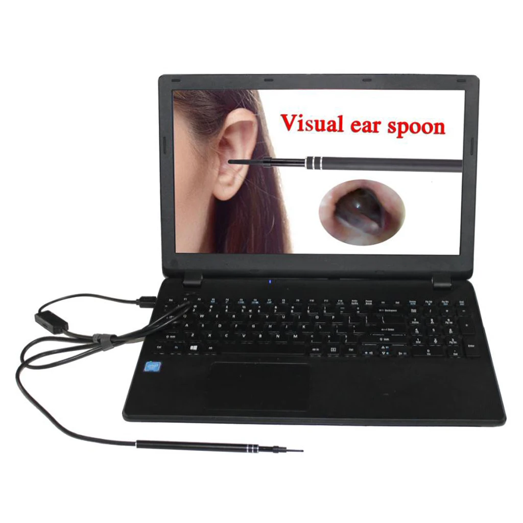

2 Pieces Visual Ear Scoop Ear Borescope 5.5mm Lens 6LED Adjustable 0.3MP