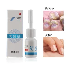 1 шт. 3 мл Лечение ногтей от грибка жидкость яркий ремонт ногтей Onychomycosis грибка эссенция для удаления эффективного параониксии облегчение боли