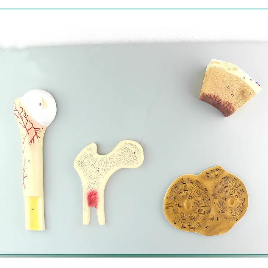 Humans Bone Structure Model,Cancellous Bone,compact Bone and Femur Bone