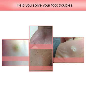 

6 Pcs Exfoliating Corn Foot Patch Soft Feet Dead Skin Remove Care Treatment Plantar Warts Calluses Away MH88