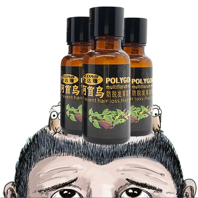Unique Fast Hair Growth Stop Hair Loss Product dense hair ...