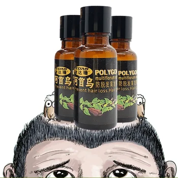 

Unique Fast Hair Growth Stop Hair Loss Product dense hair regrowth treatment Women postpartum anti hair loss Chinese medicine 3