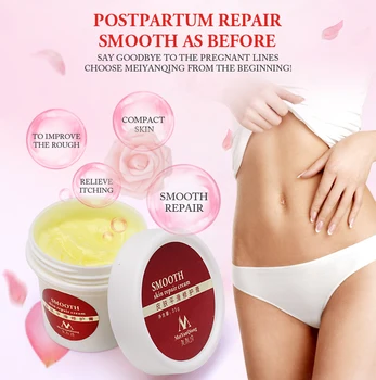 

High Quality Smooth Skin Cream For Stretch Marks Scar Removal To Remove Scar Maternity Skin Repair Care Postpartum Body Cream