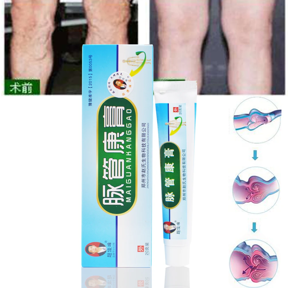 Китайский натуральная косметика фитотерапии для лечения варикозного расширения сосудов воспаление Массажный Крем для лечения варикозные вены мазь D002