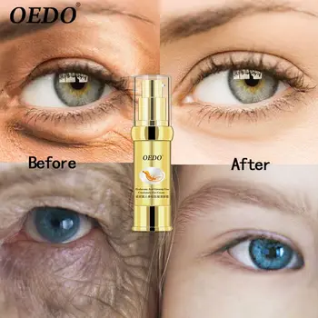 

Hyaluronic Acid Ginseng Fine Condensate Eye Cream Delicate Bright Smooth Herbal Ginseng Extract Anti-Puffiness Dark Circle Serum