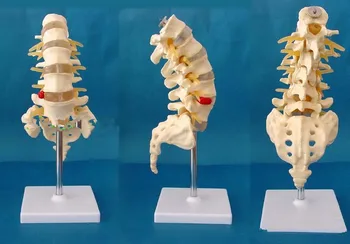 

human skeleton anatomical BIG LUMBAR VERTEBRAE W/HERNIATED DIS AND SACRUM&COCCYX OPENED AND SEEN COCCYX Model Skin in trauma