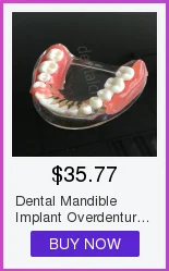 Alta Qualidade Dental Typodon Dentes Modelo - Ortodôntico Steelteeth M8017 4 High Quality Beleza e saúde