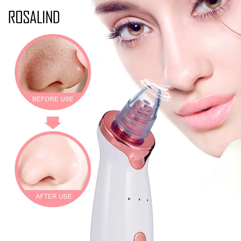 ROSALIND Blackhead Remover пылесос с usb зарядкой черный точечный очиститель пор для лица Pimple пятновыводитель для кожи средства ухода за мотоциклом