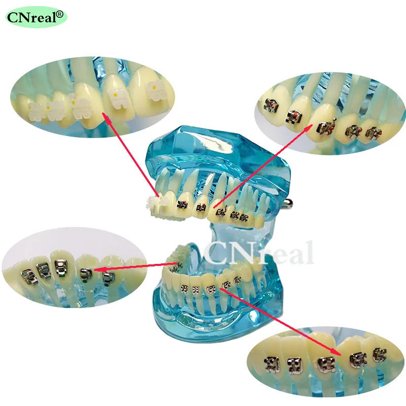 1 шт Стоматологическая модель зубов Ортодонтическая щеточка 4 типа кронштейны контраст металл/Керамика/многоязычный/самолигирующихся