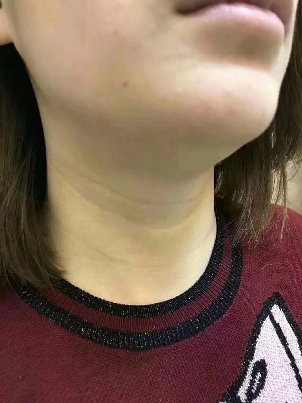 _20180916103339