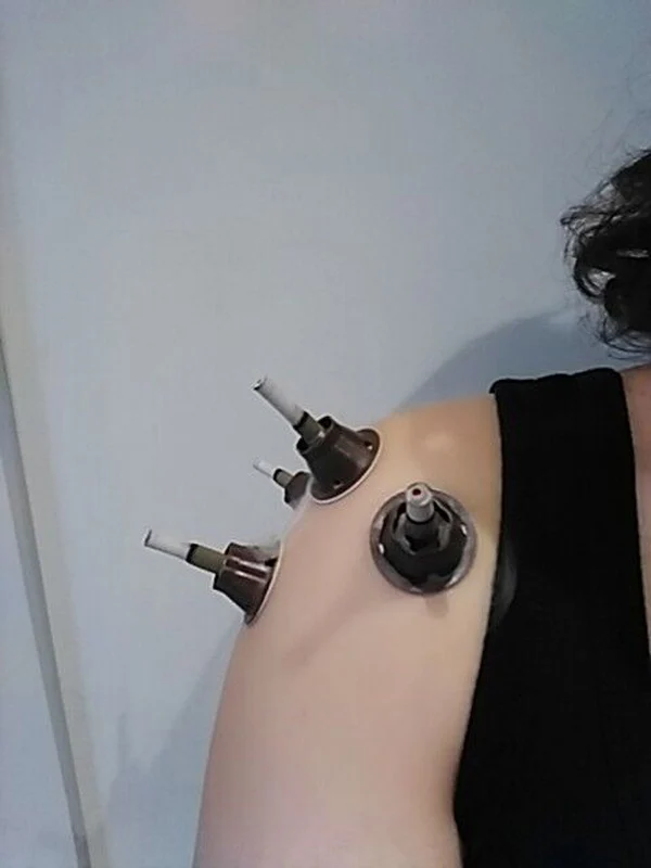 moxa moxisbution (1)