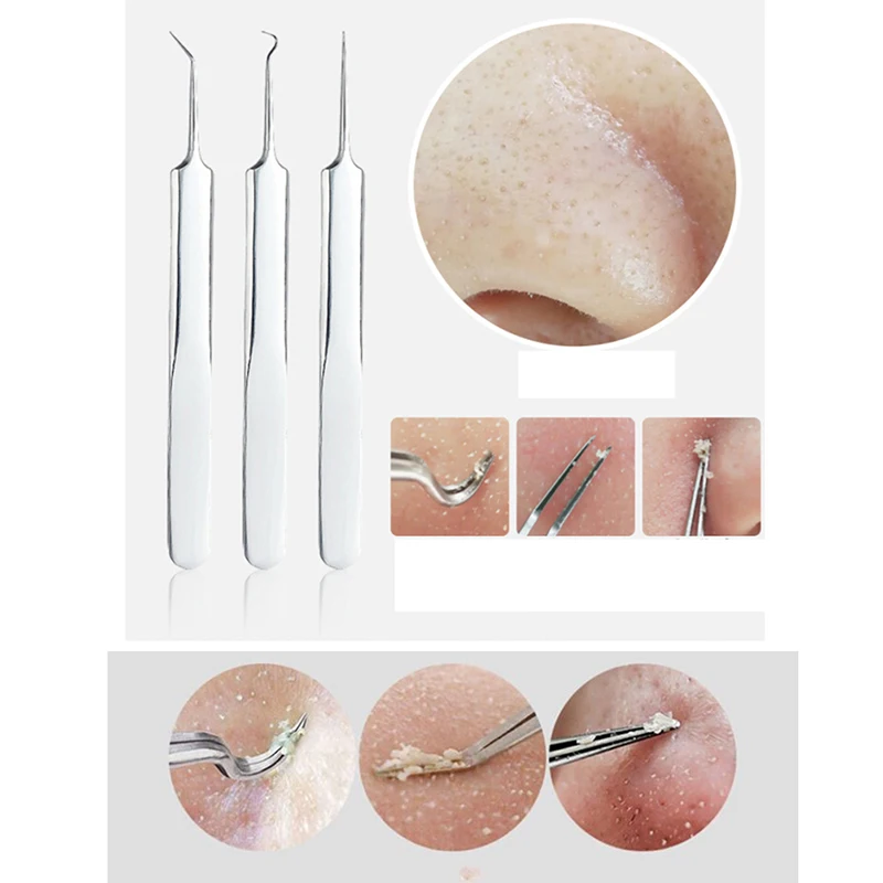 8Pcs/set Stainless Steel Blackhead Remover Skin Care Kit Black Head Acne Comedone Pimple Blemish Extractor Beauty Tool With Bag