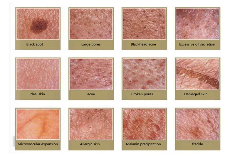 9 дюймов ЖК-анализатор кожи и волос детектор цифровой микроскоп Лупа кожа волосы угрей фолликул кожи головы детектор 50X-200X