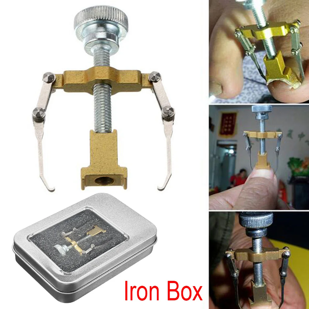 Stainless Steel Ingrown Toe Nail Fixer Pedicure Toenail Recover Correction Tool Orthotic Foot Bunion Corrector