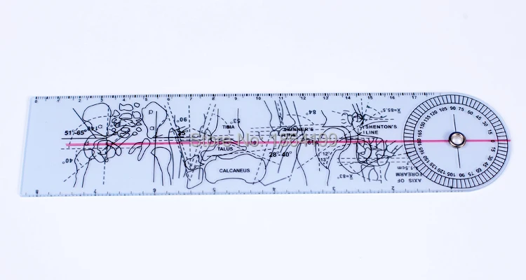 Спинного Гониометр Дистальный radioulnar совместная линейка Медицинский правителя угол транспортиром кости размеры ноги, 20 шт./лот