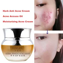 Skin Acne Treatment Blackhead Remova Anti Acne Cream Oil Control Shrink Pores Acne Scar Remove Face Care Whitening meiking face cream acne treatment moisturizing whitening hydrating shrink pores skin care collagen day creams acne scar remove