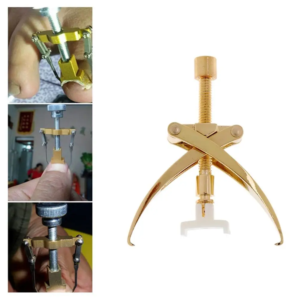 Ingrown Toenail Correction Tool Manicure Clipper Pedicure Fixer Recover Tool Teen Nail Correctie Tools