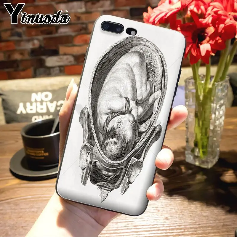 Yinuoda цветной милый чехол для телефона с анатомией человека iPhone 7plus 6S 7 xsmax xr 8 8Plus X 5S