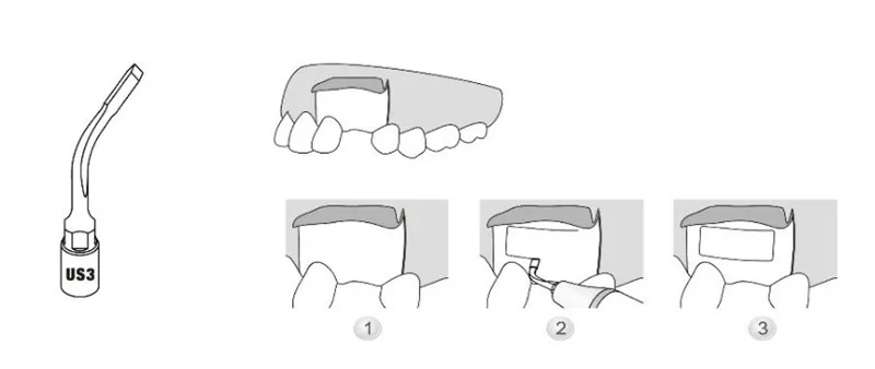 US3.