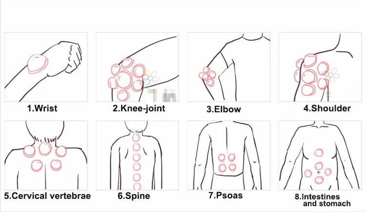 Дешевые 6 шт. hijama китайские вакуумные чашки комплект для постановки банок Вытяните вакуумный аппарат Расслабляющая терапия массажеры кривая всасывания насосы