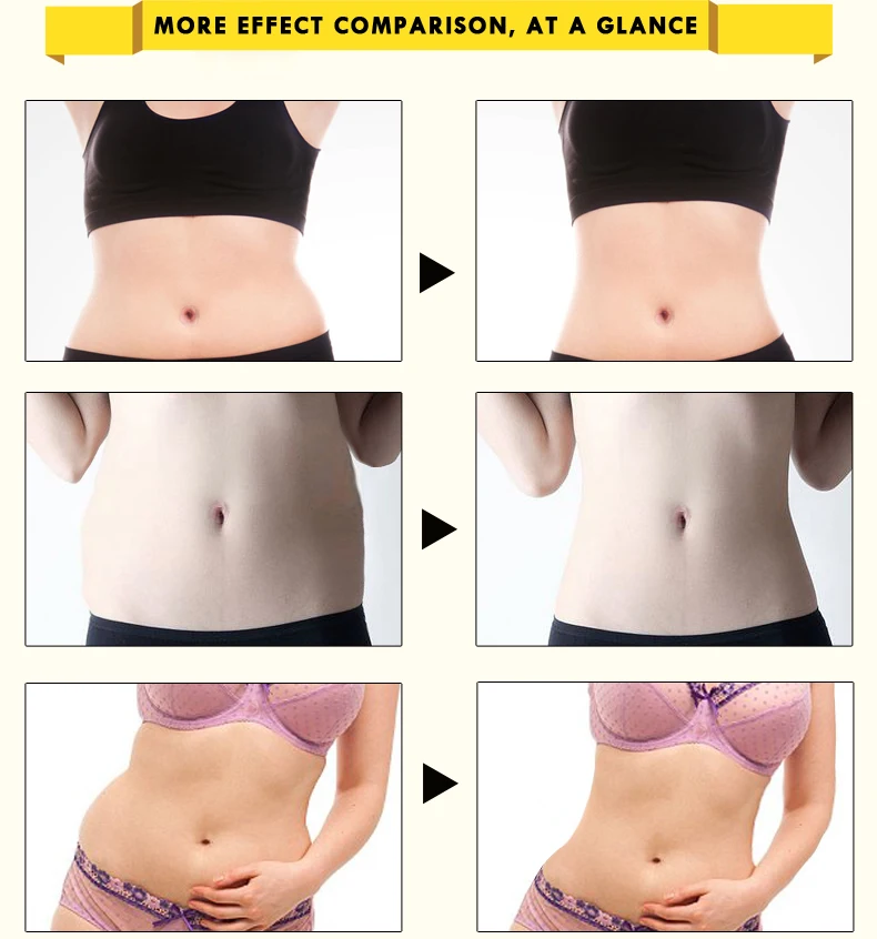 slimming cream 7 HTB1ziUuXoLrK1Rjy0Fjq6zYXFXaB
