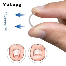 10 шт./кор. вросший носок коррекция ногтей накладки для ногтей Paronychia коррекция файла проволочный корректор инструмент для ухода за ногами