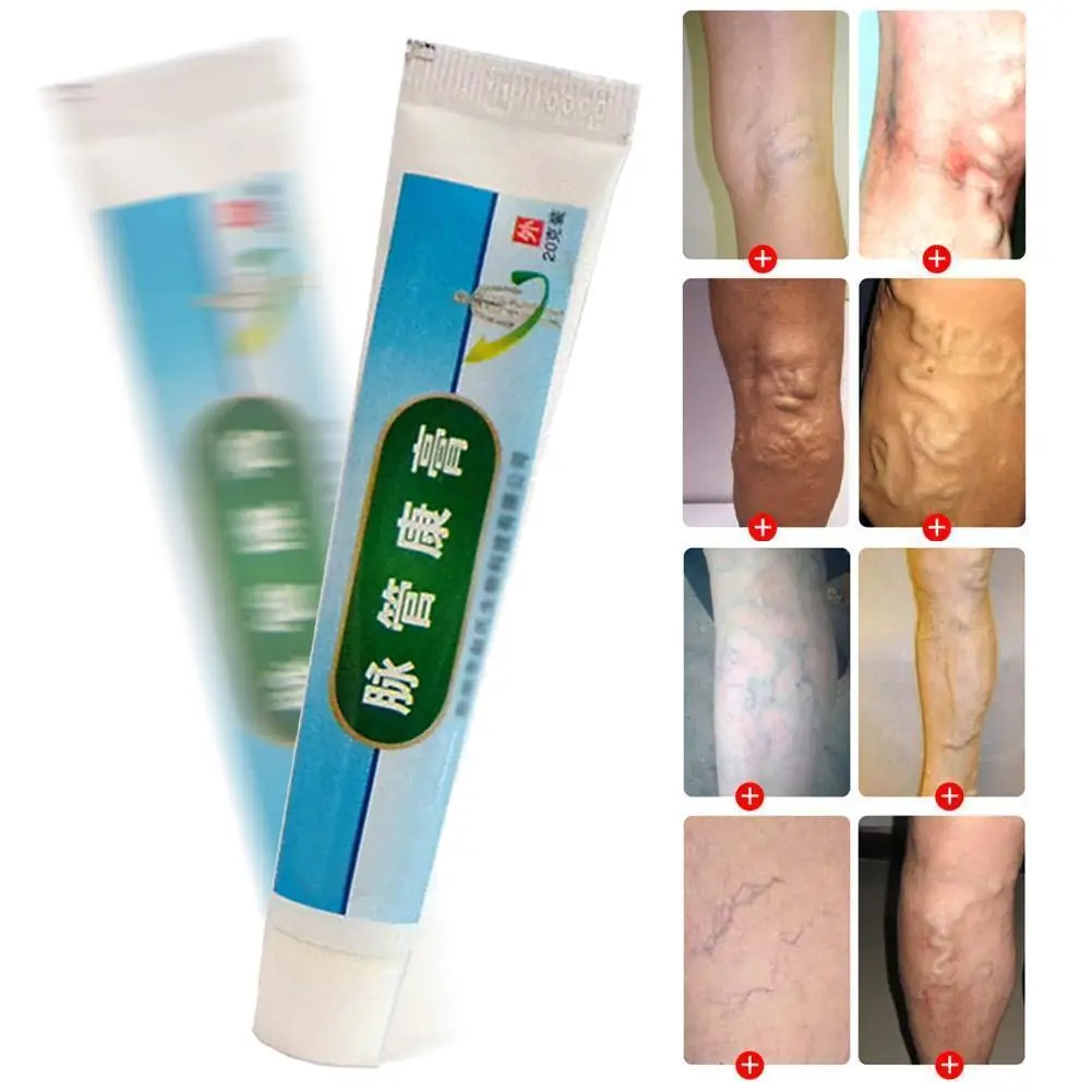 Китайская медицина Варикозная Вена мазь для массажа нижних конечностей внутривенная мазь паста спрей естественное лечение травами крем