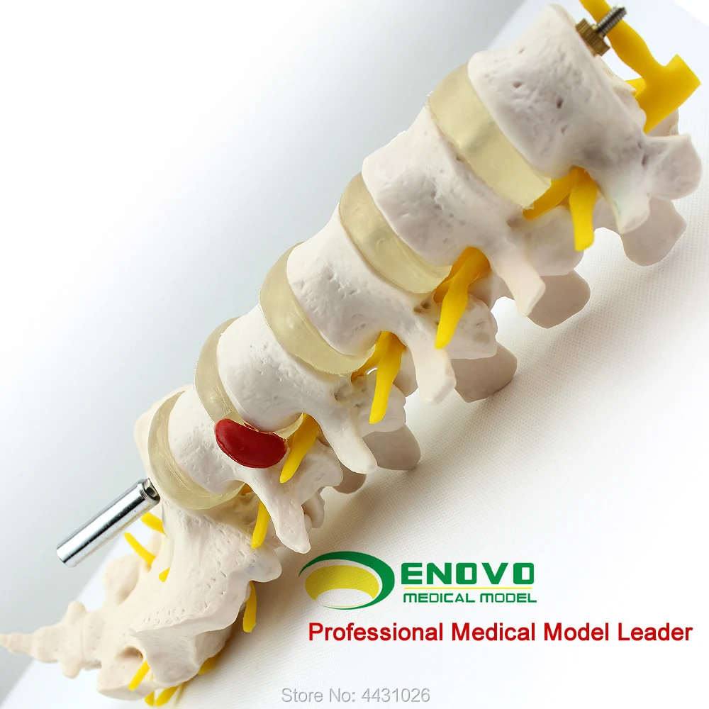 ENOVO скелет модель межпозвоночных дисков ортопедические модели