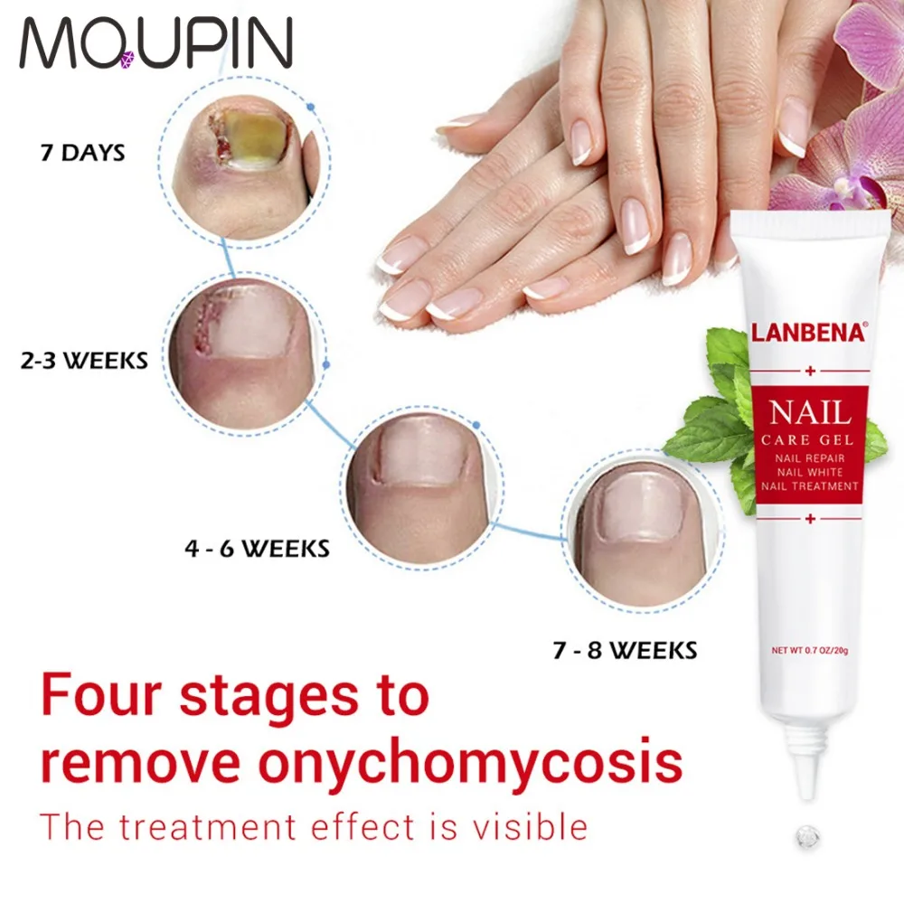 

2Pcs High Quality Nail Protector Skin Care Cream Nail Fungus Treatment Herb Nails Repair Cream Nail Care Tools With 2 Files