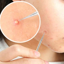 Новые 4 шт./компл. иглы для удаления угрей из нержавеющей стали для прыщей, черных точек инструмент для удаления дефектов кожи очищающий лосьон чистые инструменты