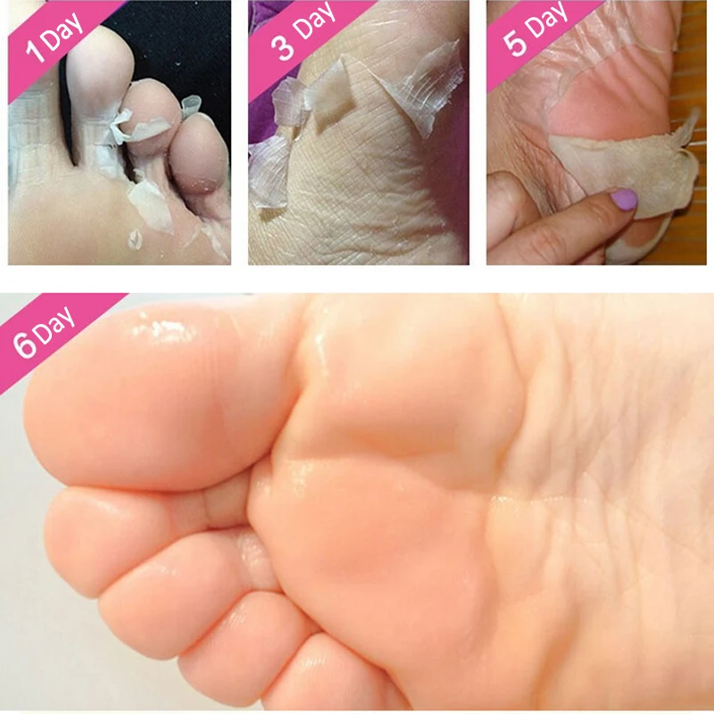 

4Pcs=2Pair Baby Feet Peel Mask Remove Dead Skin Foot Mask for Legs Exfoliating Mask Foot Care Cream Socks for Pedicure Spa Socks