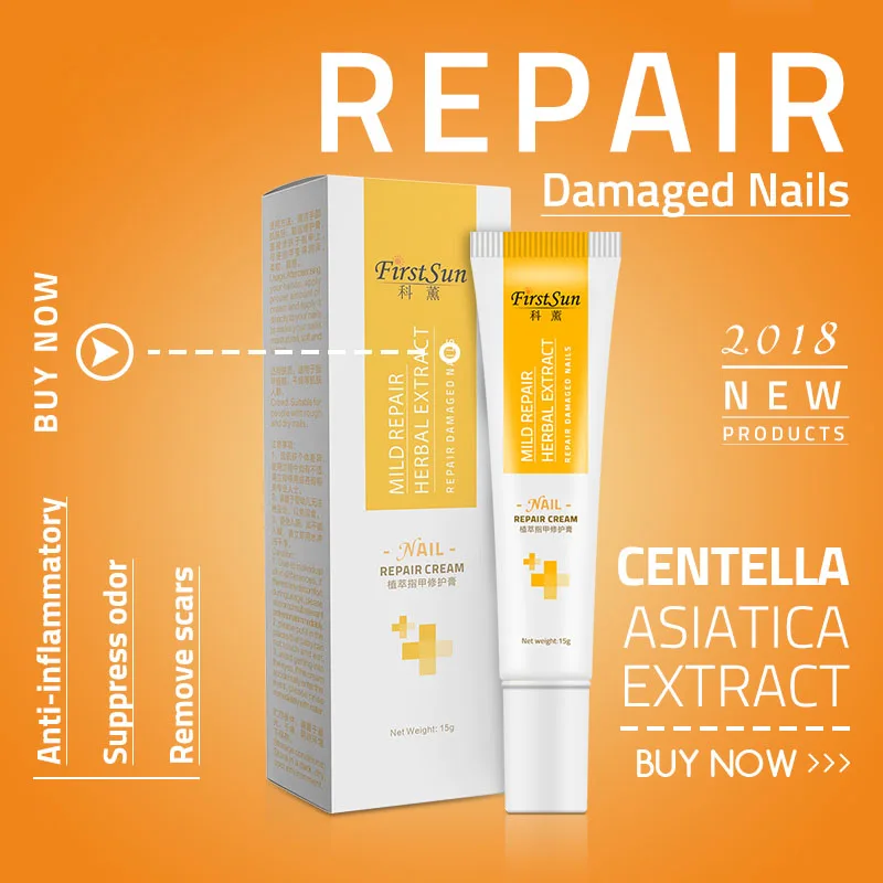 Natural Plant Antibacterial Nail Treatment Cream Nails Fungus Repair Toe Nail Care Cream Effective Onychomycosis Treatment Cream