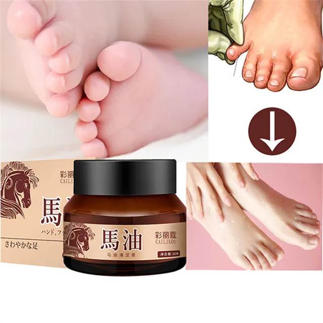 anti itch foot cream