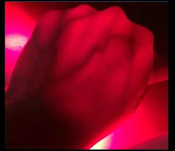 Качественный детский вены осветитель локатор для вен визуализация вены детский инфракрасный локатор для вен