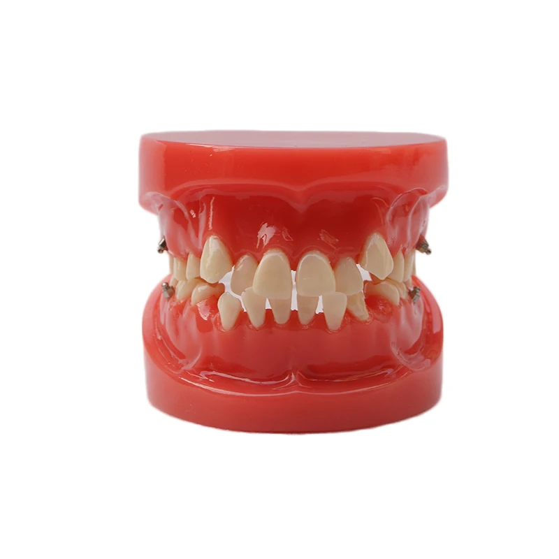 

Denture Dental Orthodontic Model Model 24 tooth HST-B1