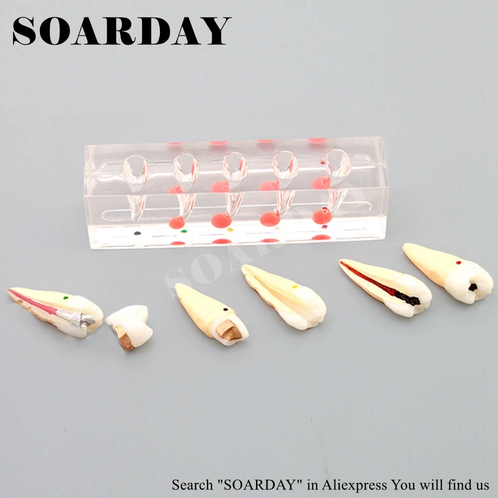 Endodontic Model (4)