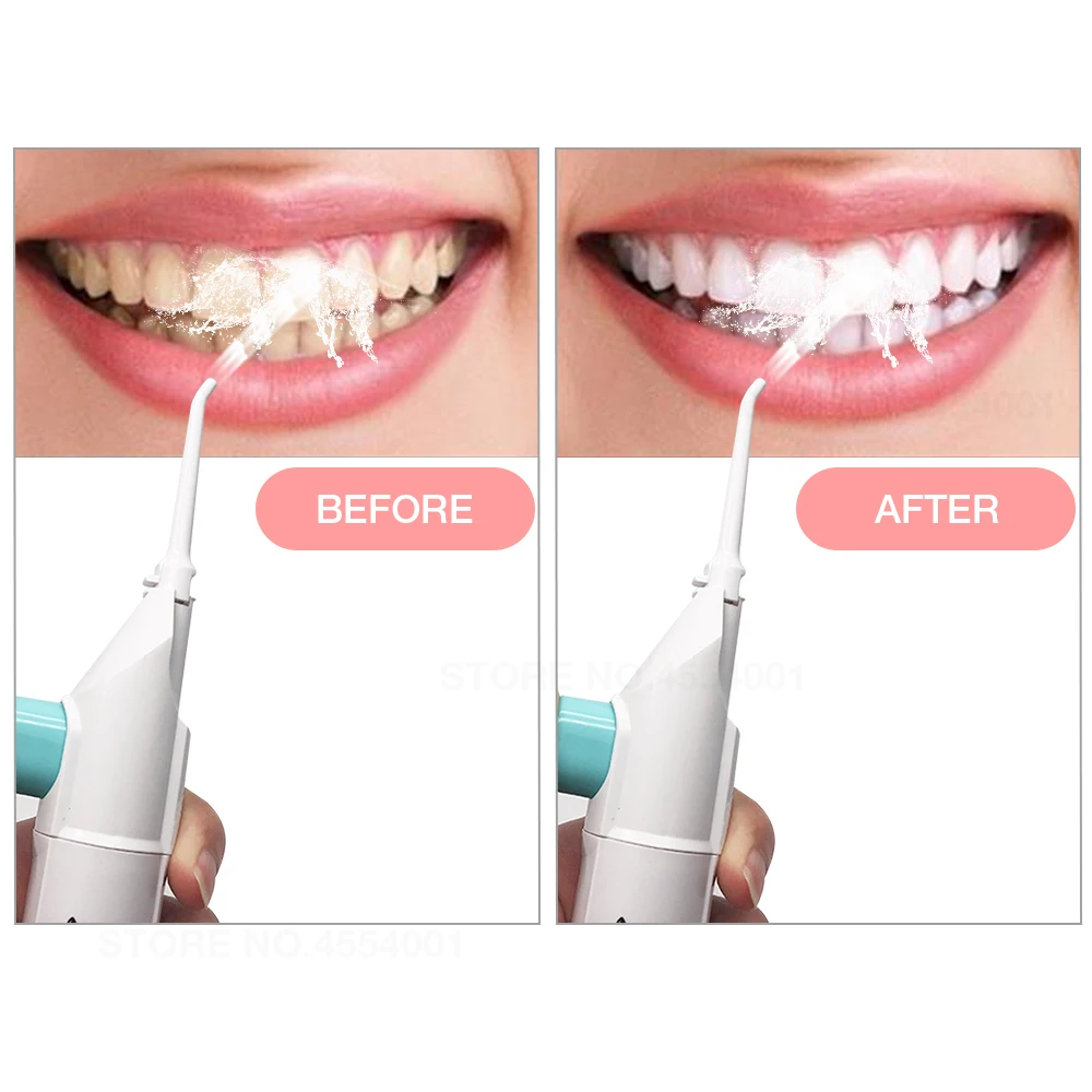 Прибор для чистки зубов. Ирригатор отбеливает зубы. Ирригатор отбеливает зубы. Ирригатор отбеливает зубы. Ирригатор waterpik портативный.