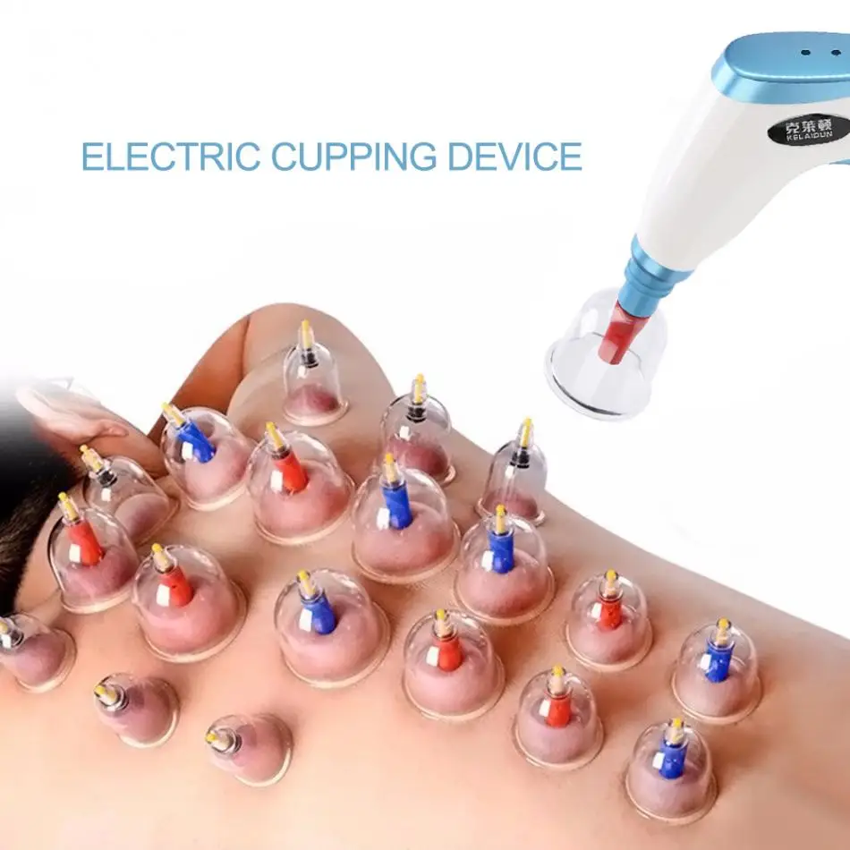 Buy Electric Vacuum Chinese Suction Body Cupping