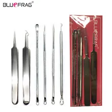 Набор инструментов для удаления угрей, инструменты для ухода за кожей лица, Комедон акне, пинцет для удаления прыщей, набор инструментов