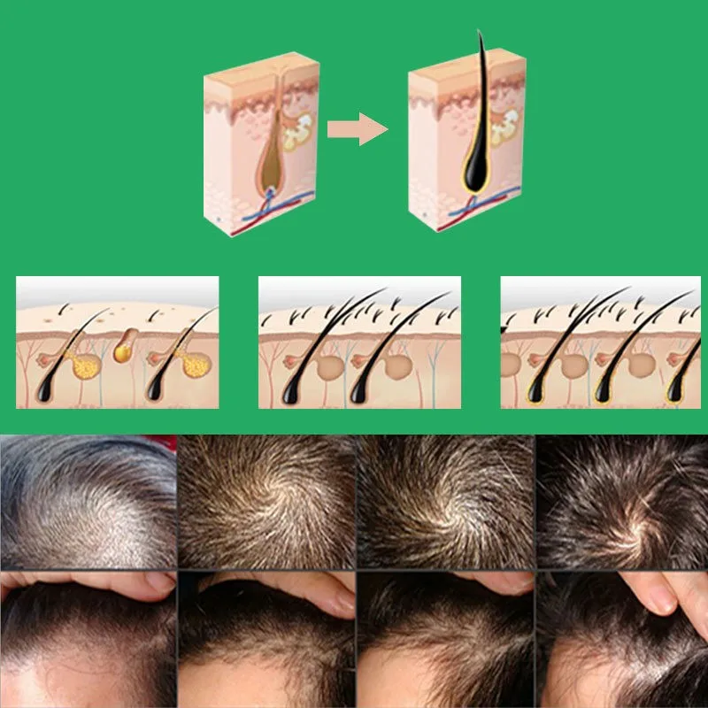 3-bottles-set-Yuda-pilatory-hair-growth-Hair-treatment-original-Sunburst-EXTRA-STRENGTH (1)