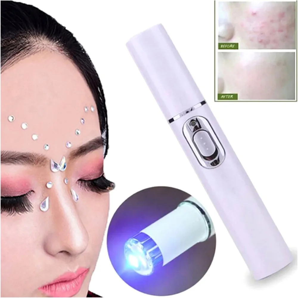 Acne Laser Pen Portable Wrinkle Removal Machine Durable Soft Scar Remover Device Blue Light Therapy Pen Massage Relax