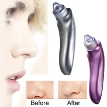 Горячая Распродажа ABS фиолетовый Серебряный Электрический лицо поры очищающее средство от черных точек для удаления вакуумной акне Комедо всасывающий косметический аппарат для лица