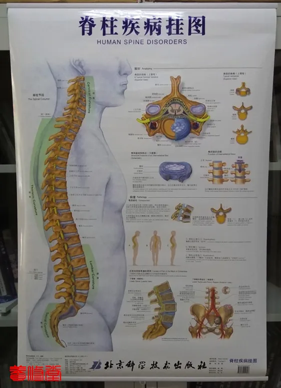 Human Spine Disorders Chart