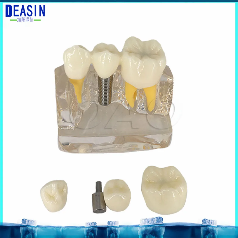 2018 deasin dentoform макро имплантатов зубов Модель Корона мост demostratation зубы tooh Typodont