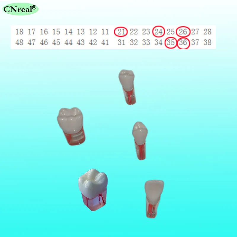 Limited Offer 4 pcs/set Endodontic Practice Model for RCT Practice