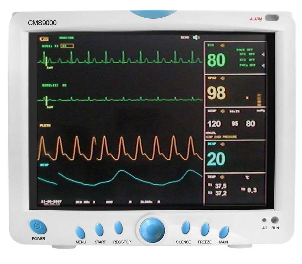 Monitor parameters