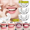 3pcs set Tooth Orthodontic Trainer Dental Tooth Appliance Alignment Brace Silicone Material Professional Guard