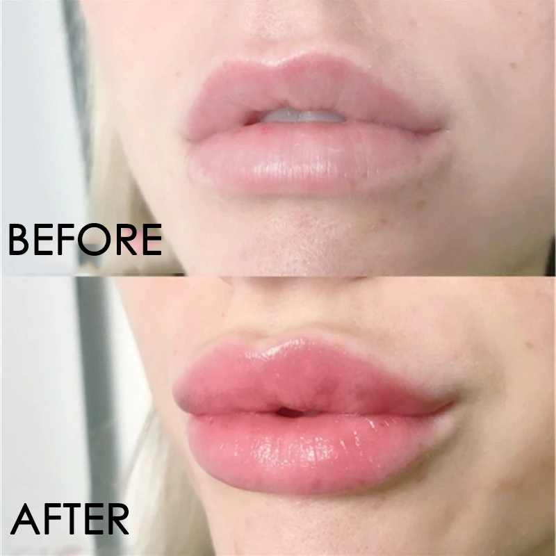 Translucent Lip Gloss Fades  Wrinkles Enhances  Elasticity Repairs Reduces  Fine Lines Brightens Lip Care