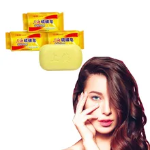 Состояние кожи традиционное серное мыло в Шанхае от акне, псориаза мазь себорейная eczema противогрибковое мыло для отбеливания ванн