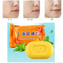 Масло-контроль акне сульфатное мыло Шанхай лечение удаления угрей мыло Отбеливающее очищающее средство Китайский традиционный уход за кожей TSLM1
